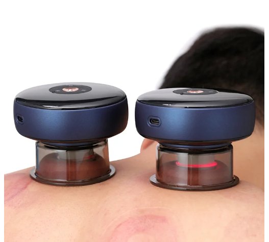 Electric Vacuum Cupping Massager - Gulf Trend